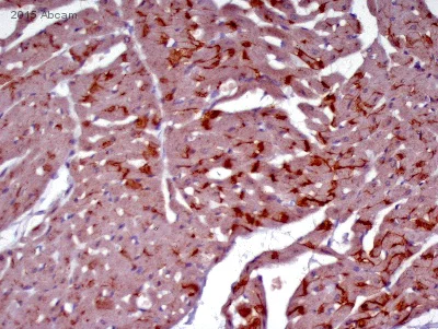 Immunohistochemistry (Formalin/PFA-fixed paraffin-embedded sections) - Goat Anti-Rabbit IgG H&L (HRP) (AB6721)