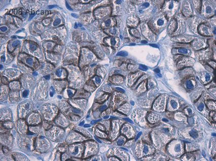 Immunohistochemistry (Formalin/PFA-fixed paraffin-embedded sections) - Goat Anti-Rabbit IgG H&L (HRP) (AB6721)