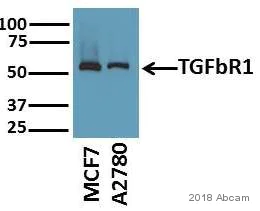 Western blot - Goat Anti-Rabbit IgG H&L (HRP) (AB6721)