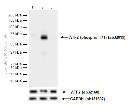 Western blot - Goat Anti-Rabbit IgG H&L (HRP) (ab97051), expandable thumbnail