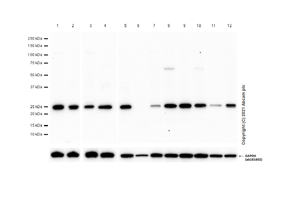 Western blot - Goat Anti-Rabbit IgG H&L (HRP) (ab97051), expandable thumbnail
