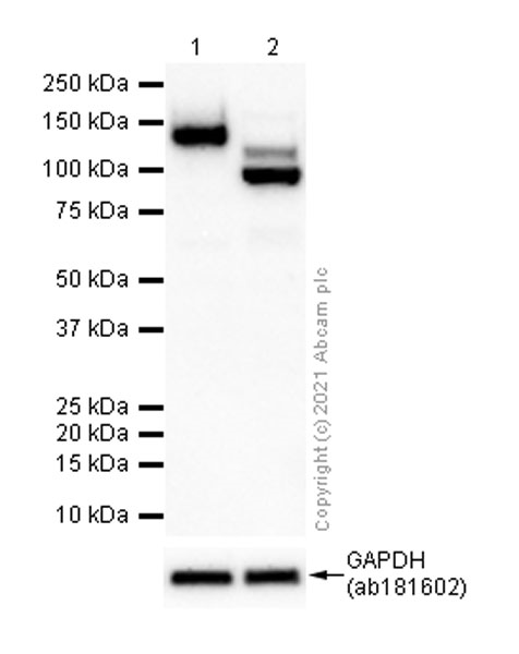 Western blot - Goat Anti-Rabbit IgG H&L (HRP) (ab97051), expandable thumbnail