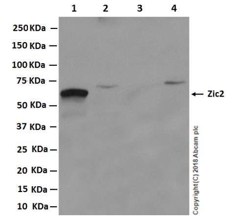 Western blot - Goat Anti-Rabbit IgG H&L (HRP) (ab97051), expandable thumbnail