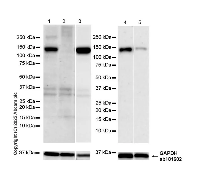 Western blot - Goat Anti-Rabbit IgG H&L (HRP) (AB97051)