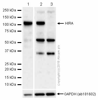 Western blot - Goat Anti-Rabbit IgG H&L (HRP) (ab97051), expandable thumbnail