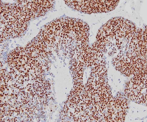 Immunohistochemistry (Formalin/PFA-fixed paraffin-embedded sections) - Goat Anti-Rabbit IgG H&L (HRP polymer) (AB214880), expandable thumbnail