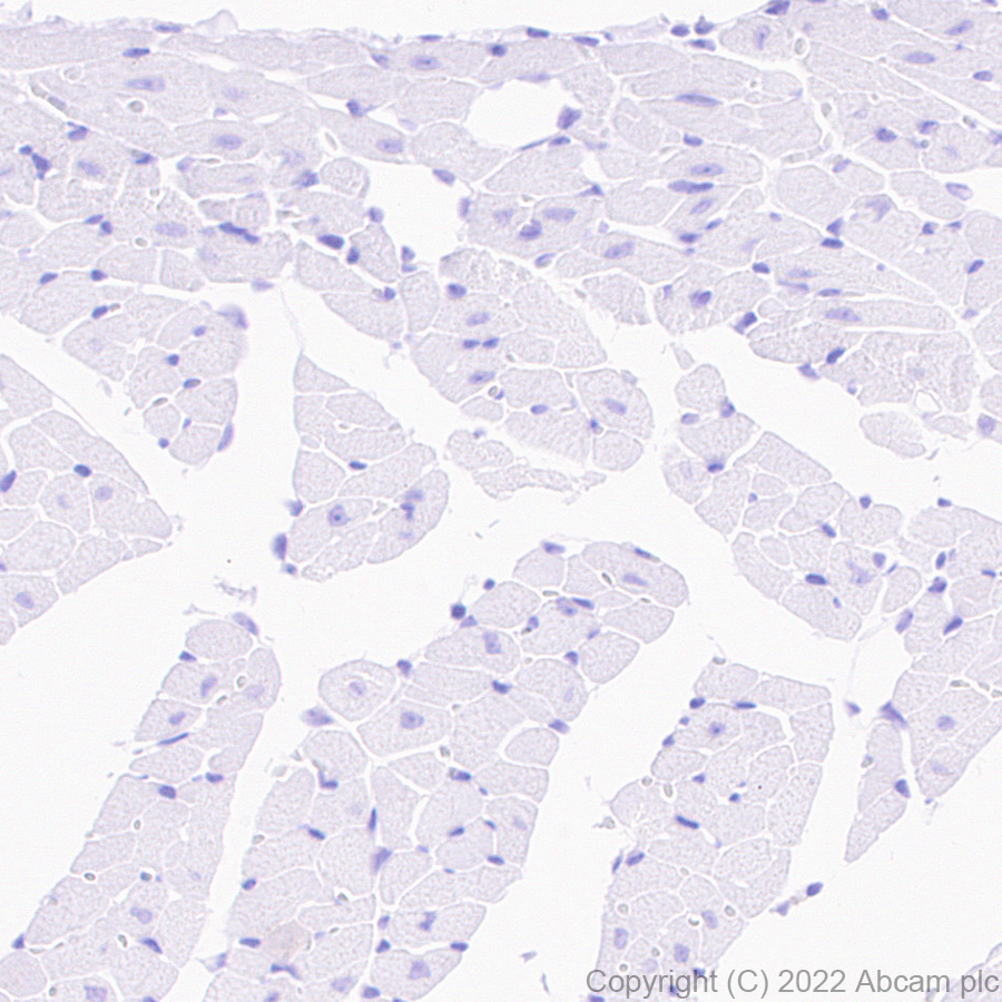 Immunohistochemistry (Formalin/PFA-fixed paraffin-embedded sections) - Goat Anti-Rabbit IgG H&L (HRP polymer) (ab214880), expandable thumbnail