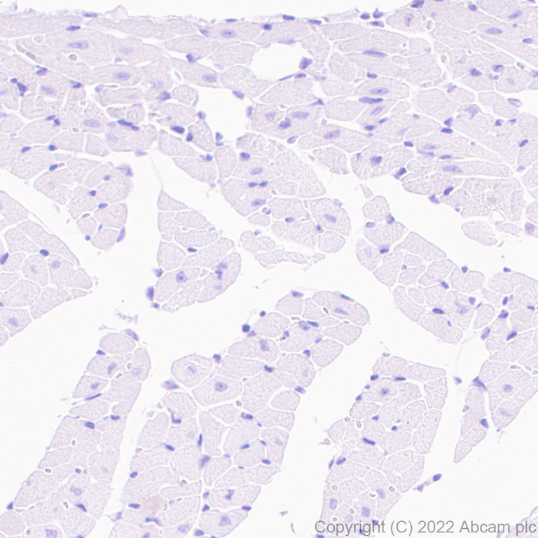 Immunohistochemistry (Formalin/PFA-fixed paraffin-embedded sections) - Goat Anti-Rabbit IgG H&L (HRP polymer) (AB214880)