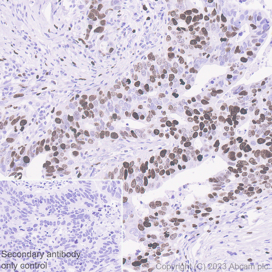 Immunohistochemistry (Formalin/PFA-fixed paraffin-embedded sections) - Goat Anti-Rabbit IgG H&L (HRP polymer) (ab214880), expandable thumbnail