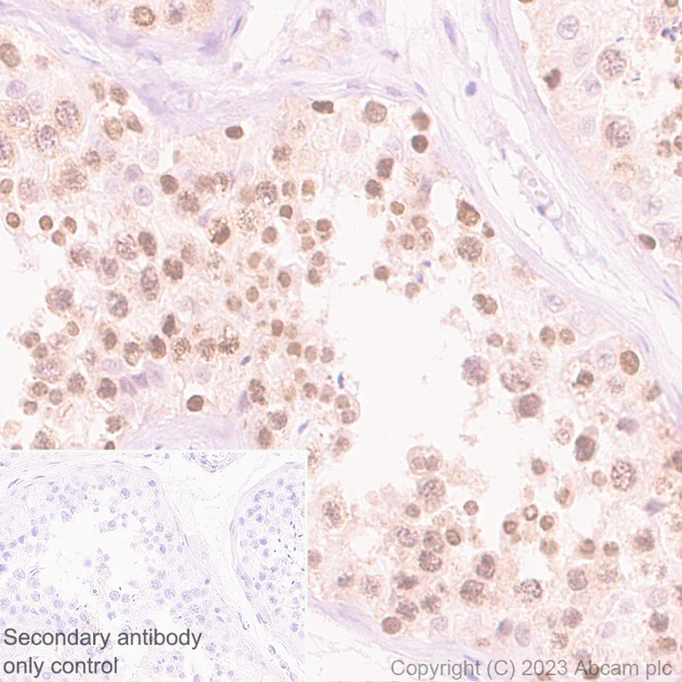 Immunohistochemistry (Formalin/PFA-fixed paraffin-embedded sections) - Goat Anti-Rabbit IgG H&L (HRP polymer) (AB214880)
