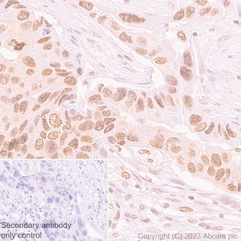 Immunohistochemistry (Formalin/PFA-fixed paraffin-embedded sections) - Goat Anti-Rabbit IgG H&L (HRP polymer) (AB214880)