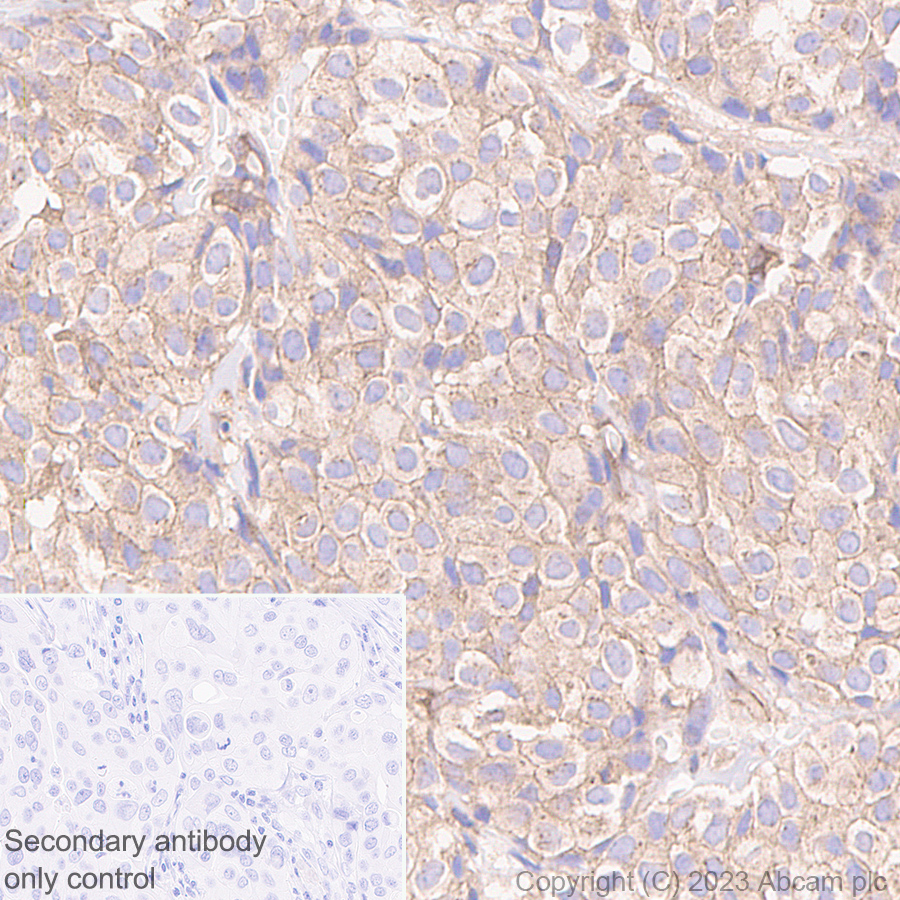 Immunohistochemistry (Formalin/PFA-fixed paraffin-embedded sections) - Goat Anti-Rabbit IgG H&L (HRP polymer) (ab214880), expandable thumbnail