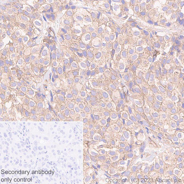 Immunohistochemistry (Formalin/PFA-fixed paraffin-embedded sections) - Goat Anti-Rabbit IgG H&L (HRP polymer) (AB214880)