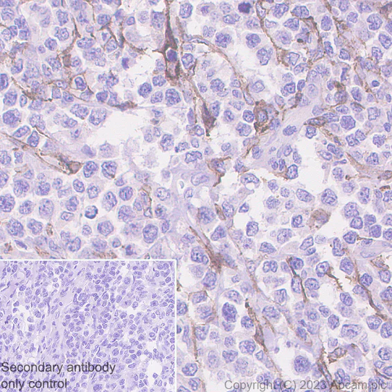 Immunohistochemistry (Formalin/PFA-fixed paraffin-embedded sections) - Goat Anti-Rabbit IgG H&L (HRP polymer) (AB214880)