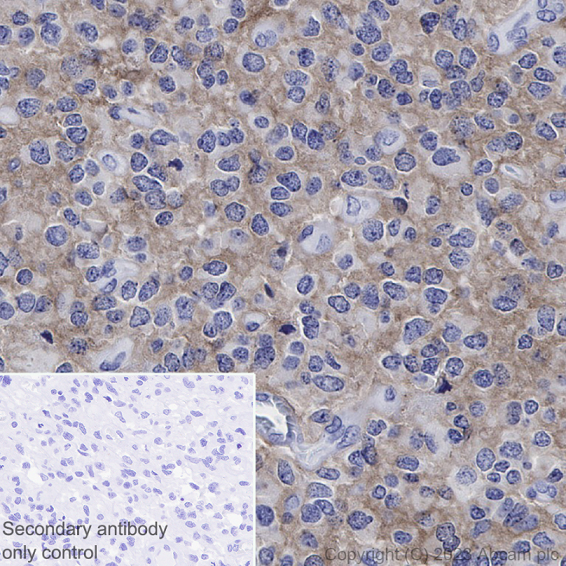 Immunohistochemistry (Formalin/PFA-fixed paraffin-embedded sections) - Goat Anti-Rabbit IgG H&L (HRP polymer) (ab214880), expandable thumbnail