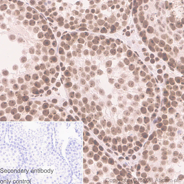 Immunohistochemistry (Formalin/PFA-fixed paraffin-embedded sections) - Goat Anti-Rabbit IgG H&L (HRP polymer) (AB214880)