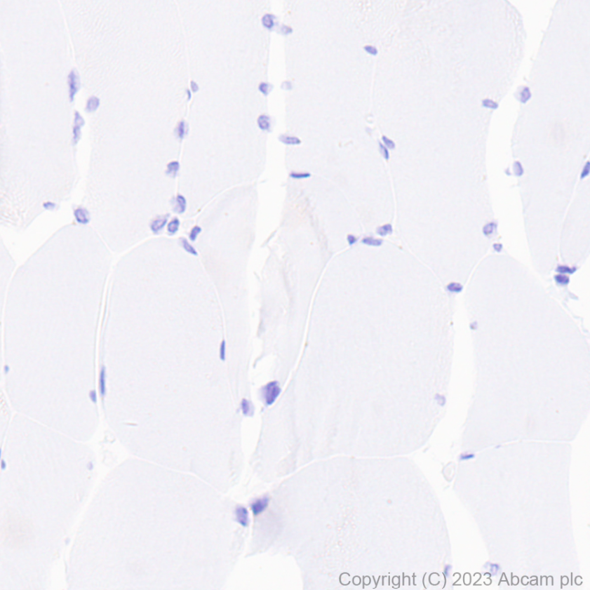 Immunohistochemistry (Formalin/PFA-fixed paraffin-embedded sections) - Goat Anti-Rabbit IgG H&L (HRP polymer) (ab214880), expandable thumbnail