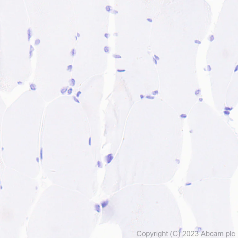 Immunohistochemistry (Formalin/PFA-fixed paraffin-embedded sections) - Goat Anti-Rabbit IgG H&L (HRP polymer) (AB214880)