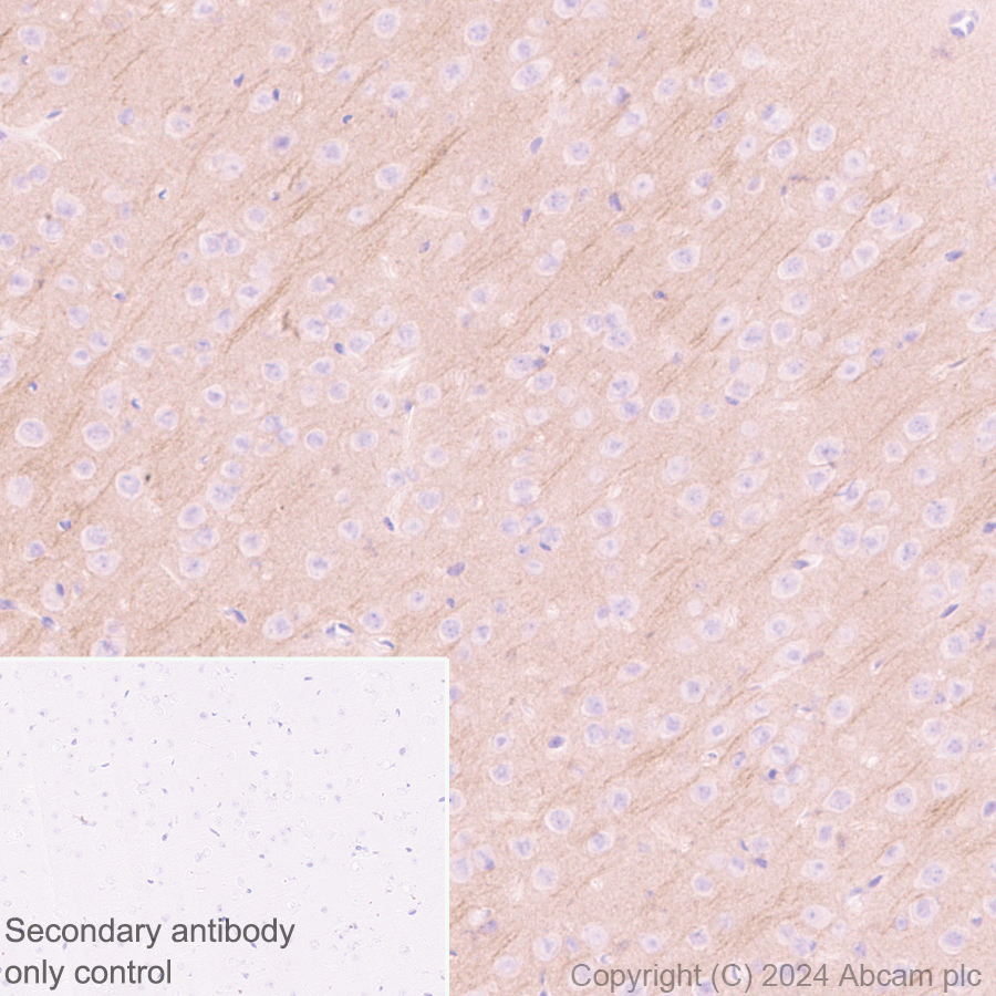 Immunohistochemistry (Formalin/PFA-fixed paraffin-embedded sections) - Goat Anti-Rabbit IgG H&L (HRP polymer) (ab214880), expandable thumbnail