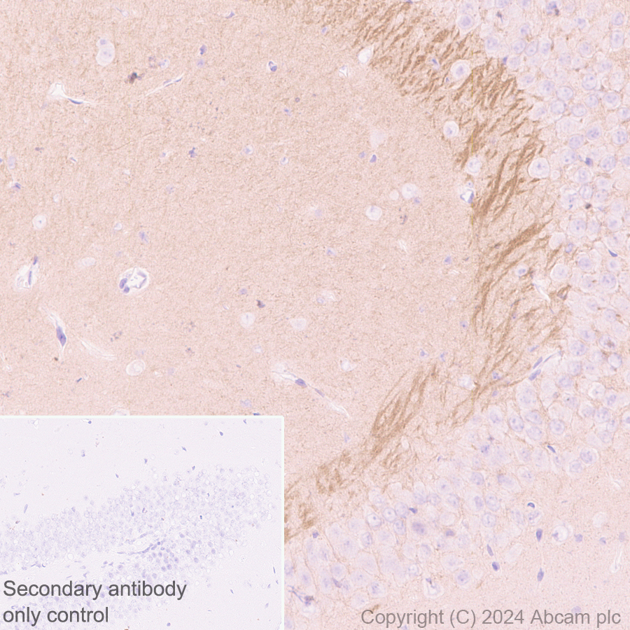Immunohistochemistry (Formalin/PFA-fixed paraffin-embedded sections) - Goat Anti-Rabbit IgG H&L (HRP polymer) (ab214880), expandable thumbnail
