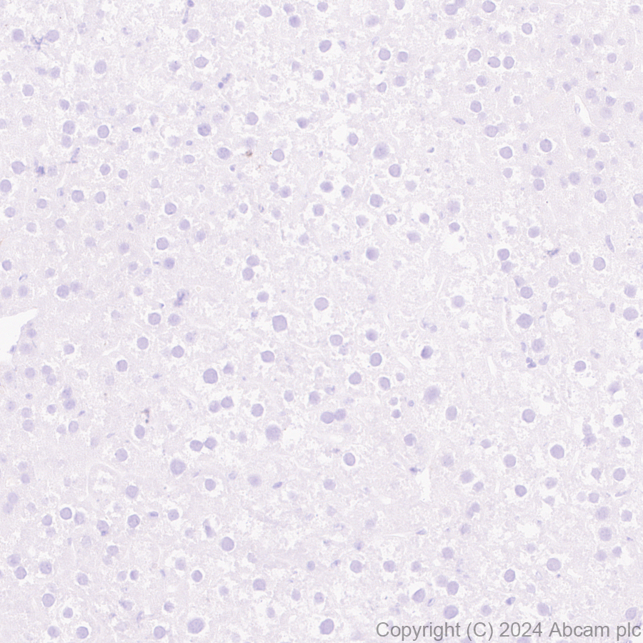 Immunohistochemistry (Formalin/PFA-fixed paraffin-embedded sections) - Goat Anti-Rabbit IgG H&L (HRP polymer) (ab214880), expandable thumbnail