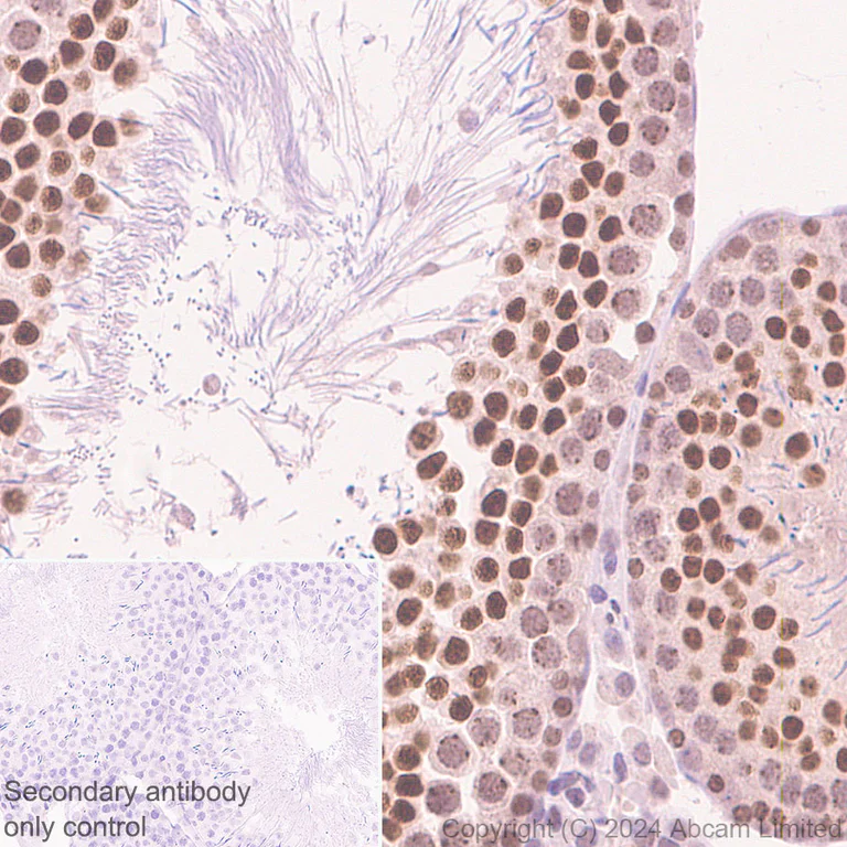 Immunohistochemistry (Formalin/PFA-fixed paraffin-embedded sections) - Goat Anti-Rabbit IgG H&L (HRP polymer) (AB214880)