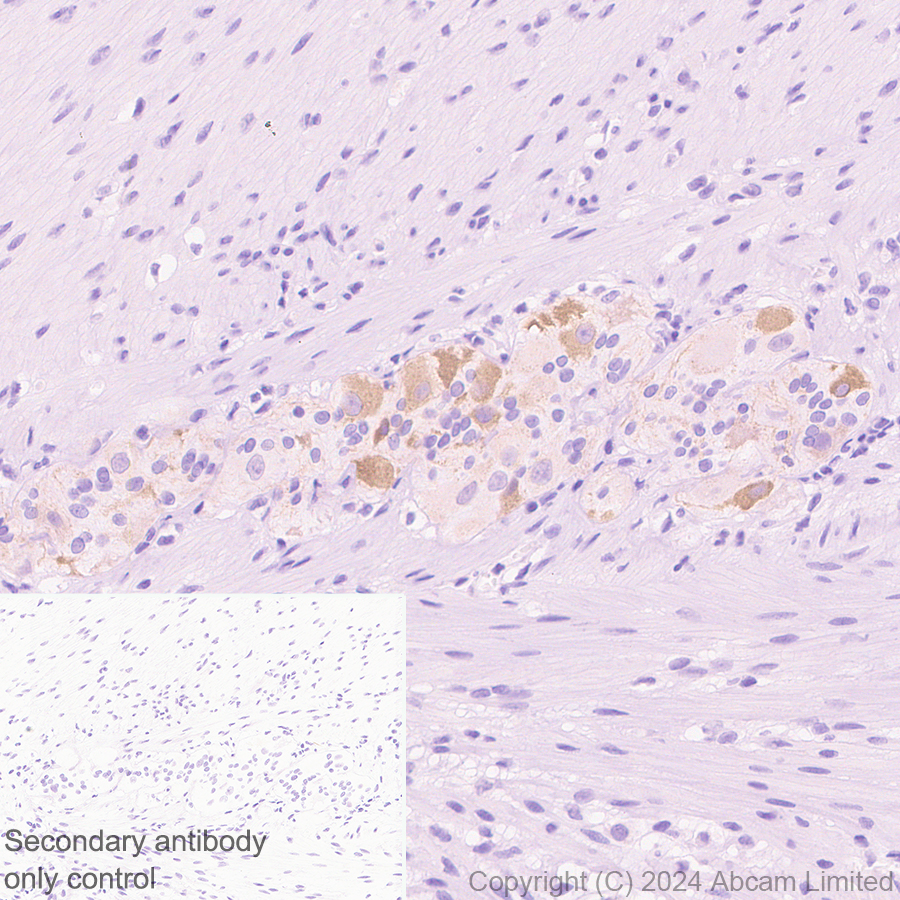 Immunohistochemistry (Formalin/PFA-fixed paraffin-embedded sections) - Goat Anti-Rabbit IgG H&L (HRP polymer) (ab214880), expandable thumbnail