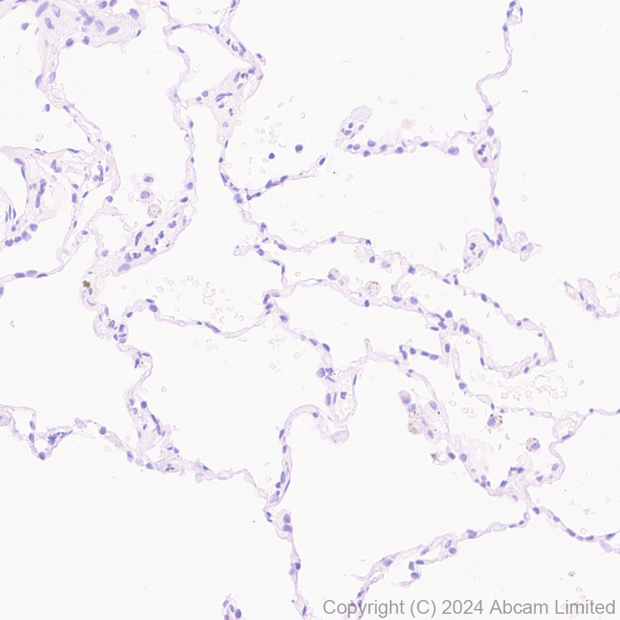 Immunohistochemistry (Formalin/PFA-fixed paraffin-embedded sections) - Goat Anti-Rabbit IgG H&L (HRP polymer) (ab214880), expandable thumbnail