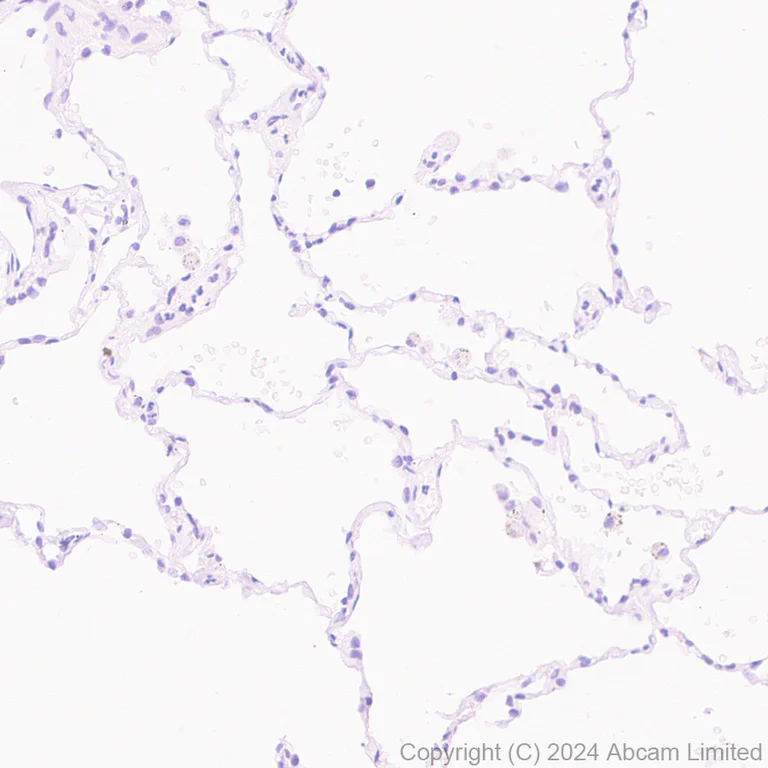 Immunohistochemistry (Formalin/PFA-fixed paraffin-embedded sections) - Goat Anti-Rabbit IgG H&L (HRP polymer) (AB214880)