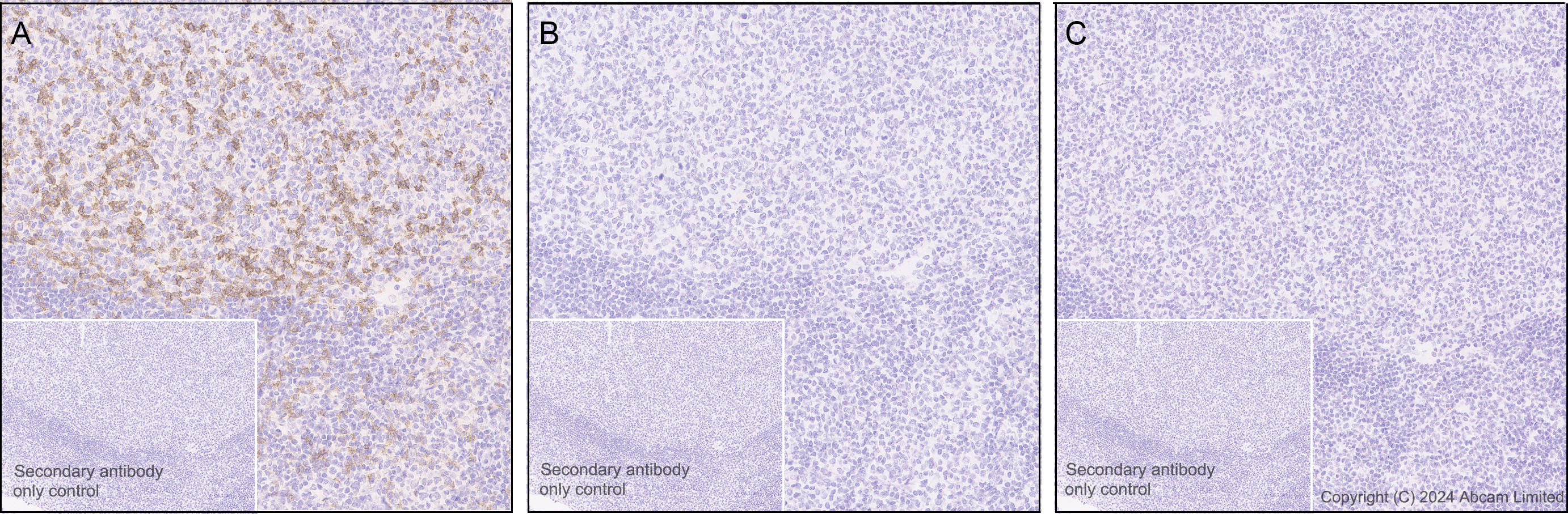 Immunohistochemistry (Formalin/PFA-fixed paraffin-embedded sections) - Goat Anti-Rabbit IgG H&L (HRP polymer) (ab214880), expandable thumbnail