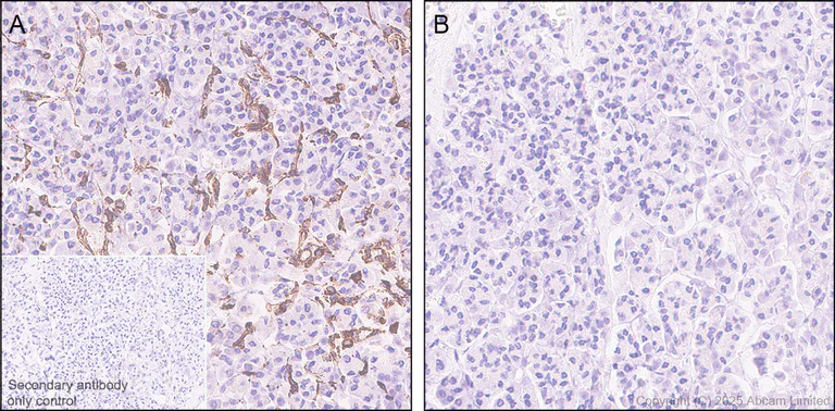Immunohistochemistry (Formalin/PFA-fixed paraffin-embedded sections) - Goat Anti-Rabbit IgG H&L (HRP polymer) (AB214880)