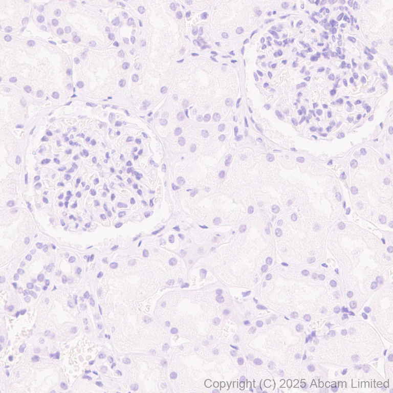 Immunohistochemistry (Formalin/PFA-fixed paraffin-embedded sections) - Goat Anti-Rabbit IgG H&L (HRP polymer) (AB214880)