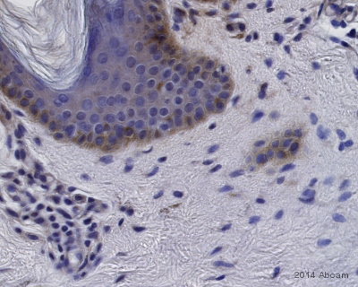 Immunohistochemistry (Formalin/PFA-fixed paraffin-embedded sections) - Goat Anti-Rabbit IgG H&L (HRP) preadsorbed (ab7090), expandable thumbnail