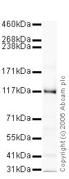 Western blot - Goat Anti-Rabbit IgG H&L (HRP) preadsorbed (AB7090), expandable thumbnail