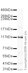 Western blot - Goat Anti-Rabbit IgG H&L (HRP) preadsorbed (AB7090)