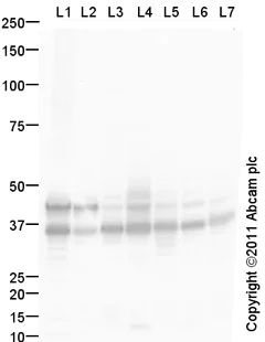 Western blot - Goat Anti-Rabbit IgG H&L (HRP) preadsorbed (AB97080)