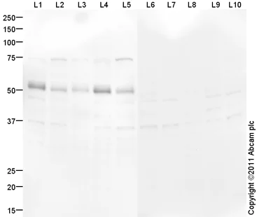Western blot - Goat Anti-Rabbit IgG H&L (HRP) preadsorbed (AB97080)
