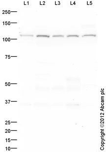 Western blot - Goat Anti-Rabbit IgG H&L (HRP) preadsorbed (AB97080)