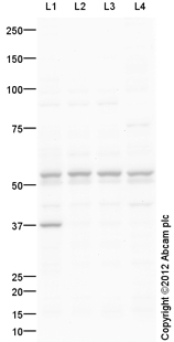 Goat Anti-Rabbit IgG H&L (HRP) preadsorbed