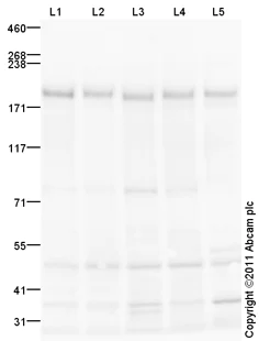 Western blot - Goat Anti-Rabbit IgG H&L (HRP) preadsorbed (AB97080)