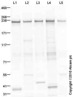 Western blot - Goat Anti-Rabbit IgG H&L (HRP) preadsorbed (AB97080)