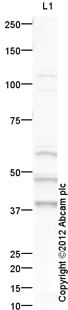 Western blot - Goat Anti-Rabbit IgG H&L (HRP) preadsorbed (AB97080)