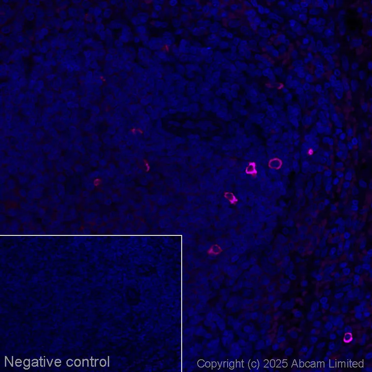 Immunohistochemistry (Formalin/PFA-fixed paraffin-embedded sections) - Goat Anti-Rabbit IgM mu chain (Alexa Fluor® 647) (AB150095)