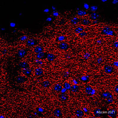Immunohistochemistry (Formalin/PFA-fixed paraffin-embedded sections) - Goat Anti-Rat IgG Fc (DyLight® 550) preadsorbed (AB96972), expandable thumbnail