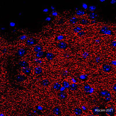Immunohistochemistry (Formalin/PFA-fixed paraffin-embedded sections) - Goat Anti-Rat IgG Fc (DyLight® 550) preadsorbed (AB96972)