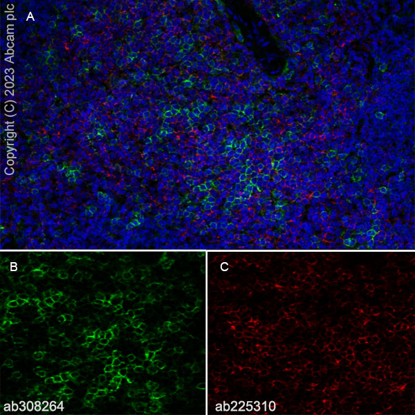 Immunohistochemistry (Frozen sections) - Goat Anti-Rat IgG H&L (Alexa Fluor® 488) (AB150157), expandable thumbnail