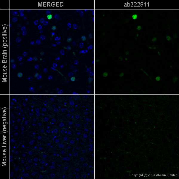Immunohistochemistry (Formalin/PFA-fixed paraffin-embedded sections) - Goat Anti-Rat IgG H&L (Alexa Fluor® 488) preadsorbed (ab150165), expandable thumbnail