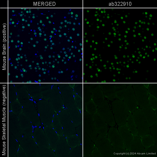 Immunohistochemistry (Formalin/PFA-fixed paraffin-embedded sections) - Goat Anti-Rat IgG H&L (Alexa Fluor® 488) preadsorbed (ab150165), expandable thumbnail