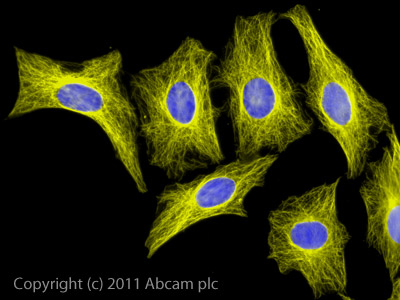 Immunocytochemistry/ Immunofluorescence - Goat Anti-Rat IgG H&L (Alexa Fluor® 555) (AB150158), expandable thumbnail