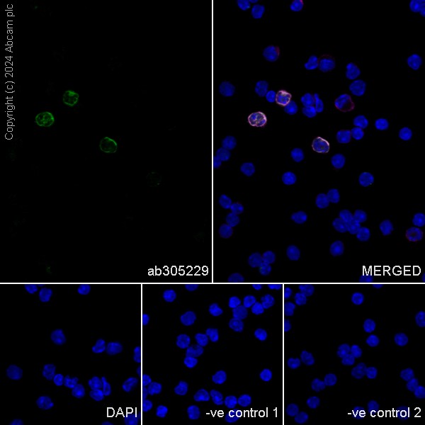 Immunocytochemistry/ Immunofluorescence - Goat Anti-Rat IgG H&L (Alexa Fluor® 594) (AB150160), expandable thumbnail
